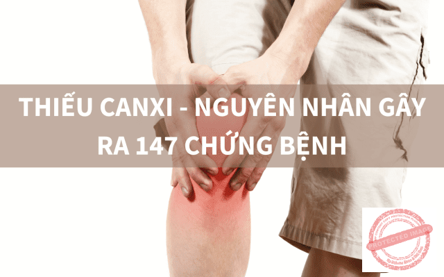Thiếu canxi gây nên 147 chứng bệnh
